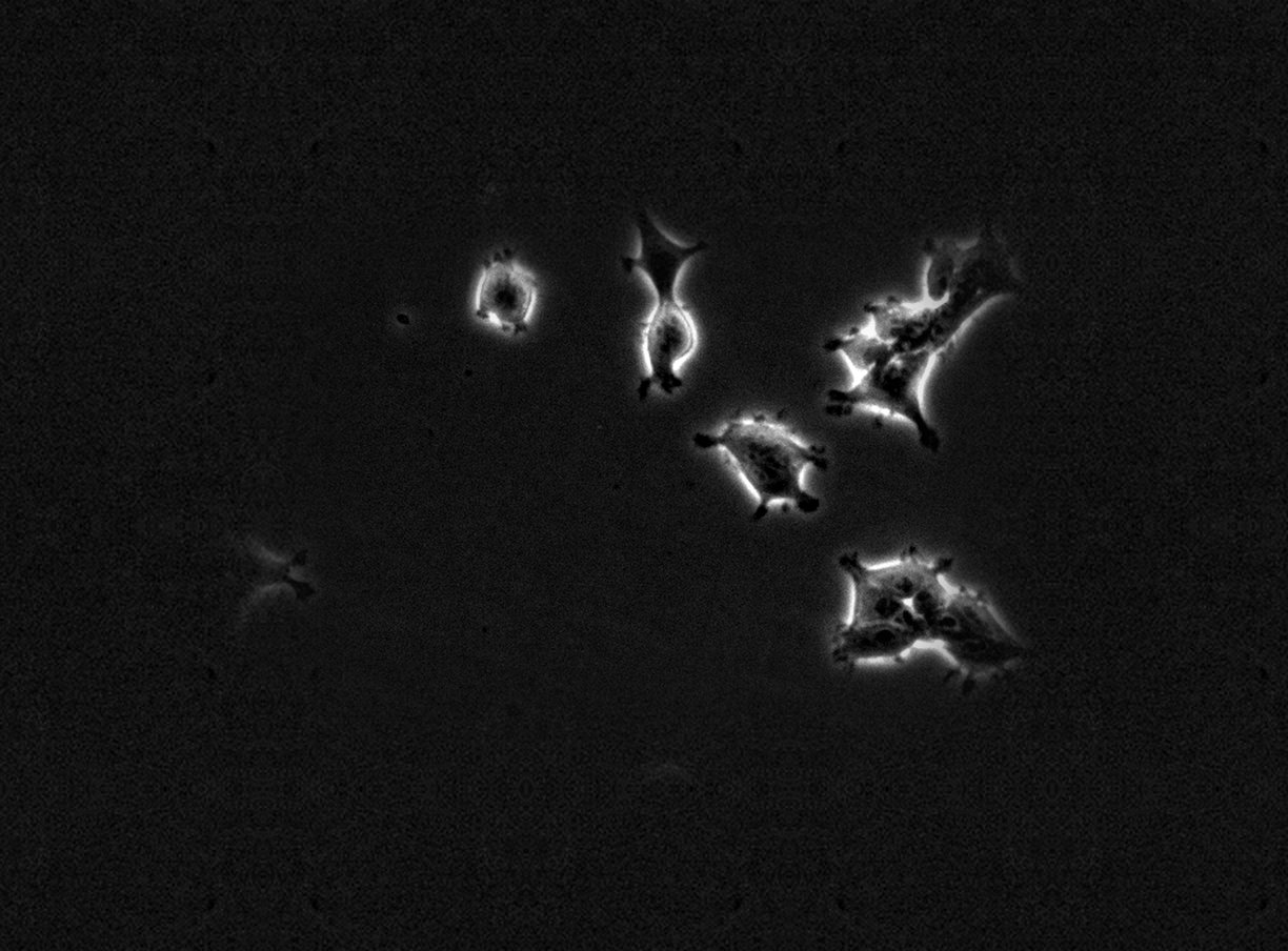 FLD_1 phase contrast 10×